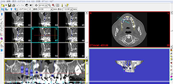 CTの活用