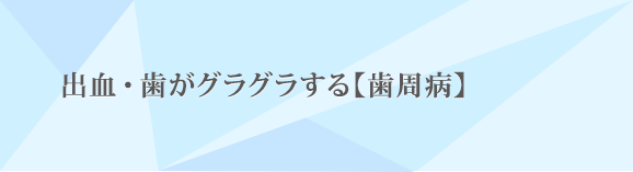 出血・歯がグラグラする【歯周病】